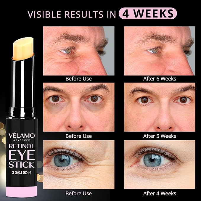 VELAMO ADVANCED Retinol Eye Stick Duo: Under Eye Cream for Dark Circles and Puffiness - Visibly Reduces Fine Lines Wrinkles Under Eye Bags in 4-8 Weeks, 2 Pcs Set
