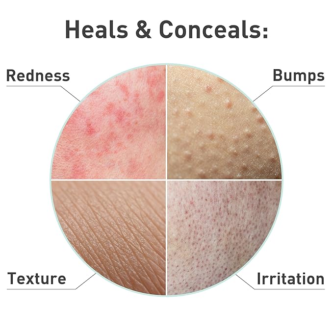 Procure Rosacare Sheet Face Mask - 5 Pack