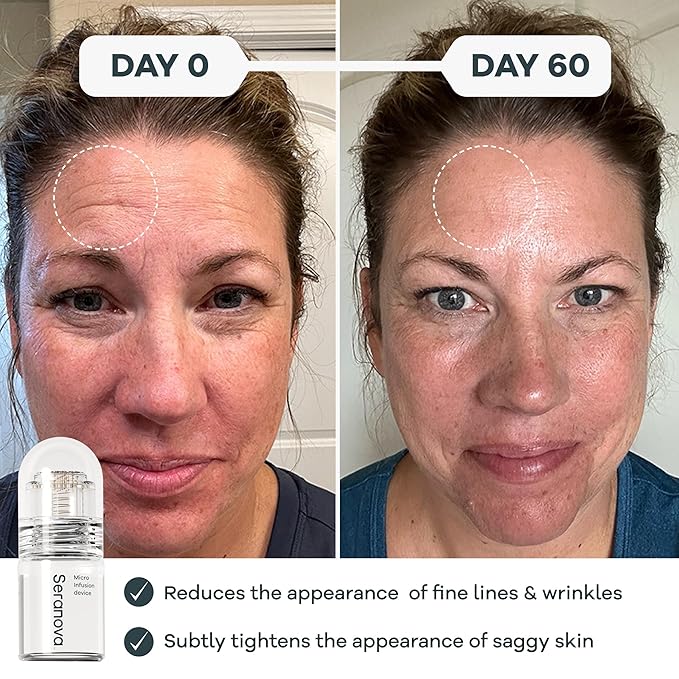 Seranova - Micro Infusion for Skin Care – with Collagen Peptides & Hyaluronic Acid, Face Serum and Stamp 0.05mm - 2 Month Supply