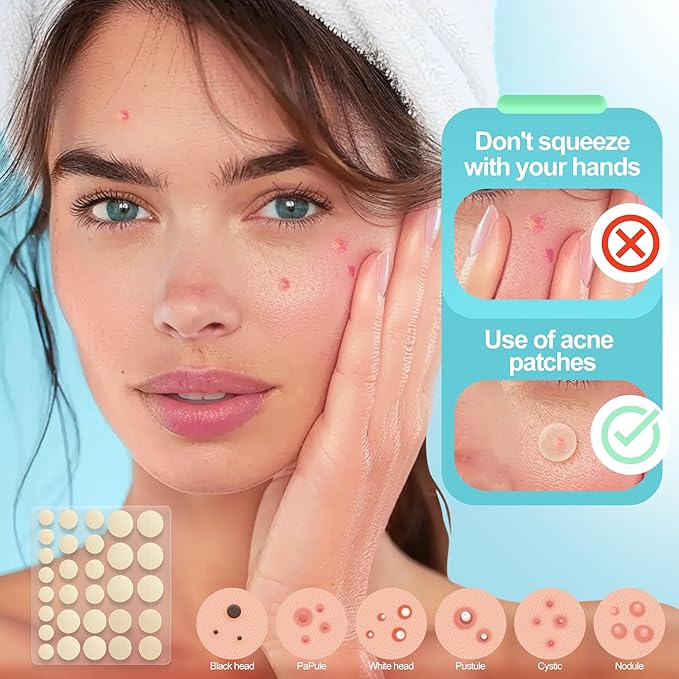 Pimple Patches for Face 5pack,Hydrocolloid Acne Pimple Patches for Covering Zits and Blemishes