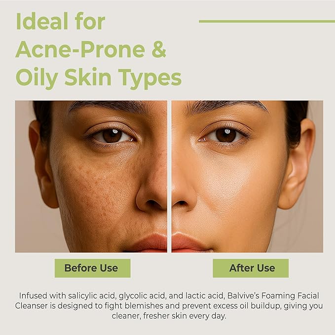 Foaming Facial Cleanser with Salicylic Acid, Glycolic Acid & Lactic Acid & Green Tea Extract– Face Wash for Acne, Oily & Sensitive Skin – Makeup Remover & Pore-Cleansing Skincare 6.7 fl oz