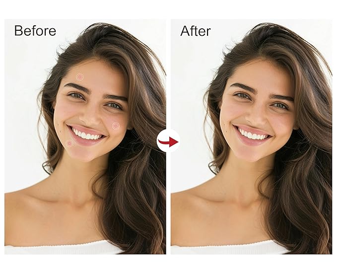 (3¢ Each) Pimple Patches 324 Pack - Hydrocolloid Acne Patches with Salicylic Acid & Tea Tree Oil - 4 Sizes S/M/L/XL - Face Acne Treatment - Easy Peel Perforated Sheets