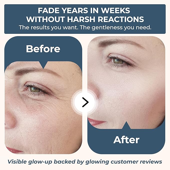 Véraglo Simply Stunning Skincare Set, Retinol Face Serum and Hydrating Cream, Anti-Aging Brightening Moisturizer with Hyaluronic Acid and Collagen for Wrinkles, Fine Lines and Dark Circles