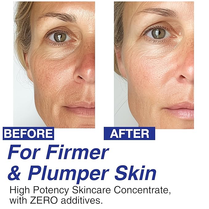 100% Pure Volufiline Concentrate Mix-in Serum - Skin Firming Solution & Clinically Proven | Anti-Wrinkle, Enhances Facial Contours, Boosts Collagen for Sagging Mature Skin Korean Skincare