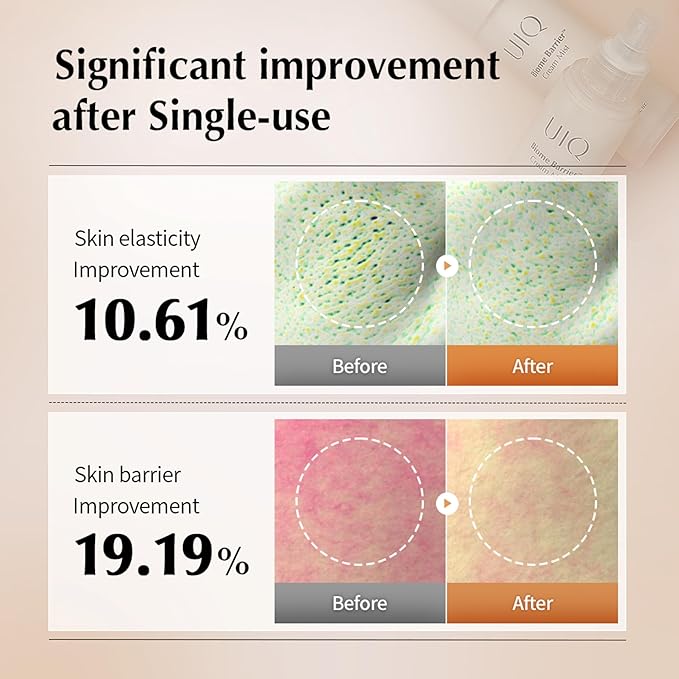 UIQ Biome Barrier Cream Mist - Facial Barrier Mist for Hydration & Skin Barrier Repair, Microbiome-Based Korean Skin Care, 3.38 fl oz