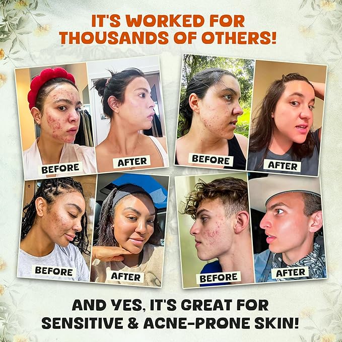 Whipped Beef Tallow and Honey Balm Moisturizer for Skin, Face, Lips, Body - Unscented