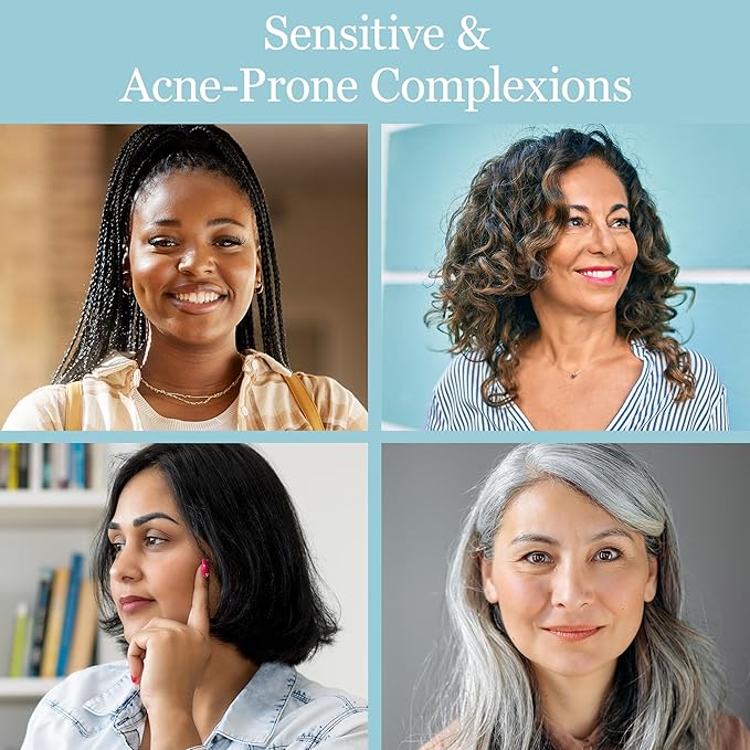 Sea Buckthorn Healing Lotion, 4oz – Soothing Moisturizer with MSM, Black Willow Bark & Zinc Oxide – Organic, Vegan – Repairs Acne, Redness & Skin Irritation